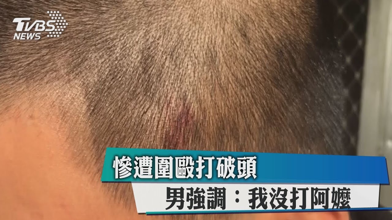 慘遭圍毆打破頭 男強調:我沒打阿嬤