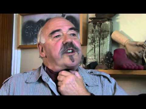 Communication after laryngectomy.mov