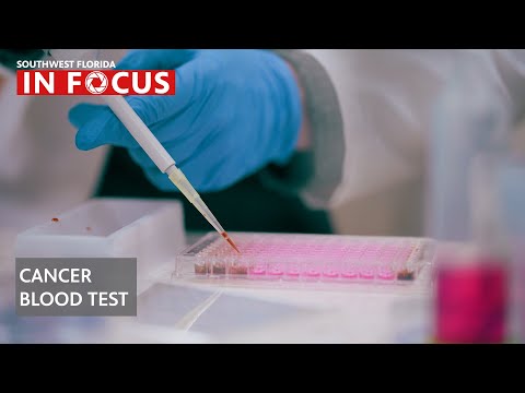 Breakthrough Blood Test Finds Cancer Before a Tumor Forms | WGCU News