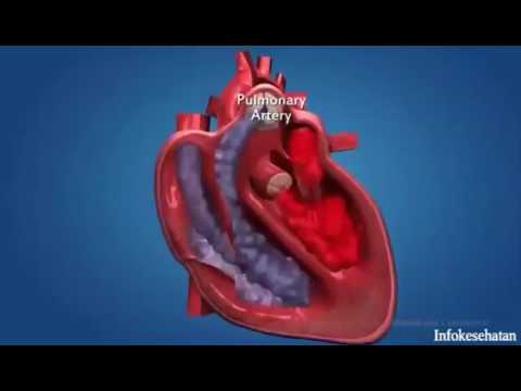 Bagaimana meningkatkan potensi obat pria rakyat Expander untuk pembesaran penis dengan tangan mereka