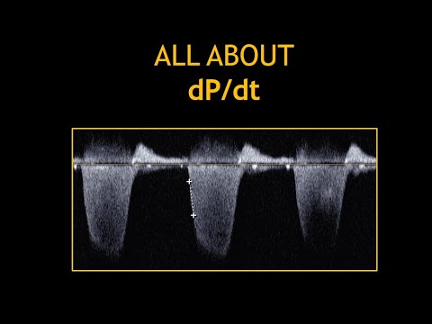 All about: DP/DT (Echocardiography)!
