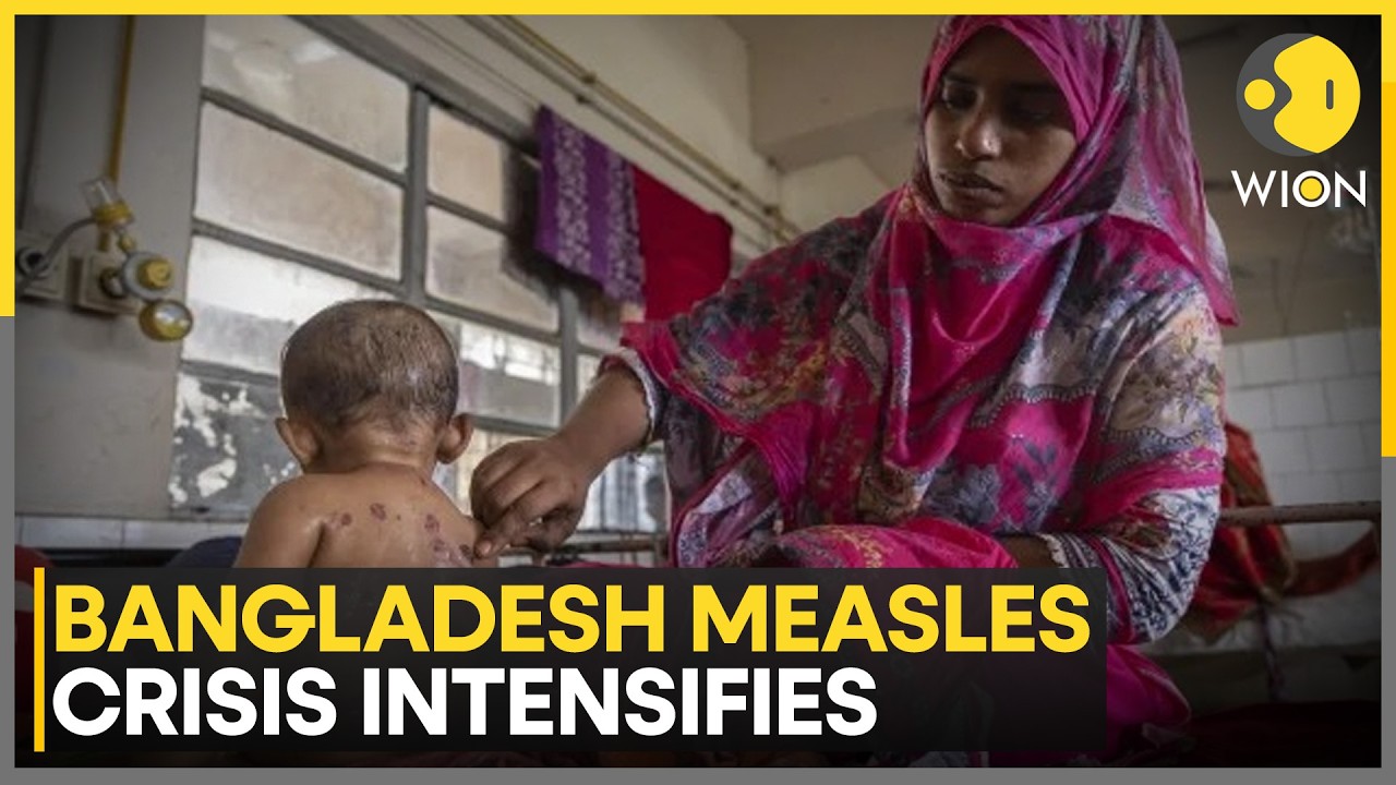 Bangladesh Measles Crisis: Death Toll Increases To 528 | WION