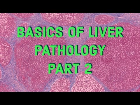  BASICS OF LIVER PATHOLOGY II PART 1 II SYSTEMIC PATHOLOGY II LIVER II ROBBINS 10TH EDITION