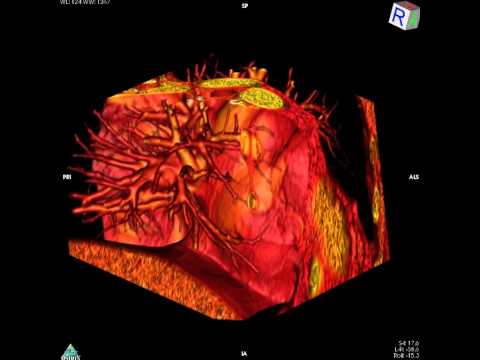 Mal di schiena in vita Acquistare ARTROMOT per articolazione del ginocchio