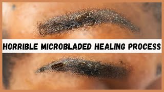 Watch this before you consider microblading your eyebrows | Microblading eyebrows healing process