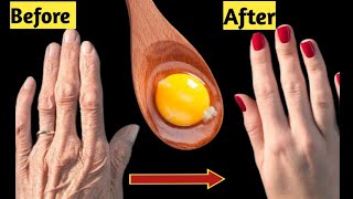 Absolute Best Remedy for Dry and Wrinkled Hands and foot|best remedy for dry hands