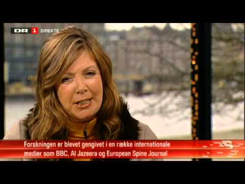 Behandling af rygsmerter som skyldes Modic forandringer med antibiotika. Hanne Albert i Aftenshowet