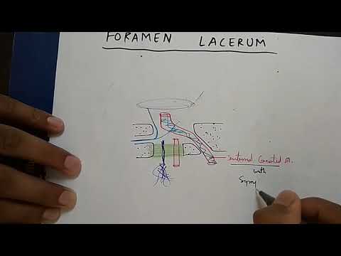 download lagu mp3 mp4 Foramen Lacerum, download lagu Foramen Lacerum gratis, unduh video klip Download Foramen Lacerum Mp3 dan Mp4 Music Gratis