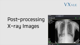 VXvue Quick Guide 03. Post-processing X-ray Images