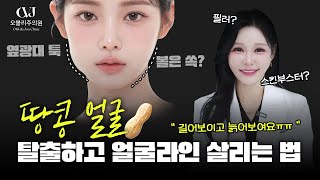 '이거' 하나면 5살 어려 보여요.. 꺼짐 리프팅 끝판왕 시술 비교 분석!