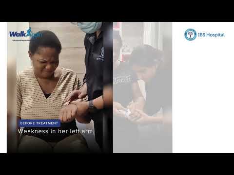 Intracerebral Hemorrhage Recovery | Brain Bleed & Weakness to Walking Again | IBS Hospital Delhi