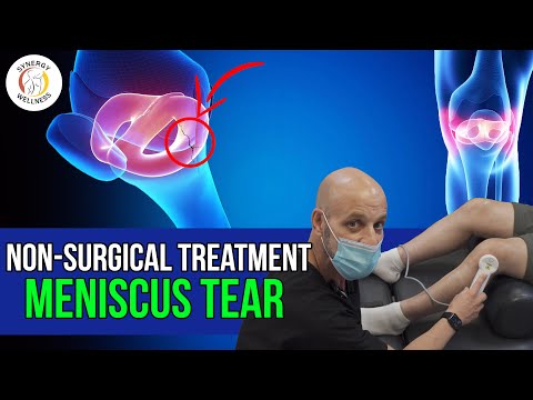 Meniscus Tear - Best Non-Surgical Treatment (Cold Laser)