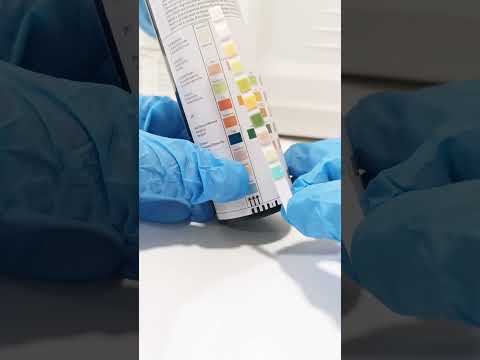 urine reagent strips #urinalysis #urine #medtechstudent #medtech #laboratory #clinicalmicroscopy