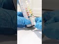 Urine Reagent Strips Urinalysis Urine Medtechstudent Medtech Laboratory Clinicalmicroscopy