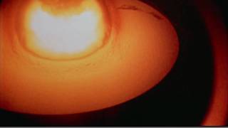 Castle Bravo - Huge thermonuclear explosion
