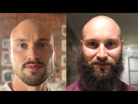 Bald Men Look Most Attractive With A Big Beard?