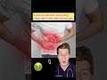 A man with right sided lower abdominal pain…what’s the diagnosis? (PART 1) #shorts #medical #doctor
