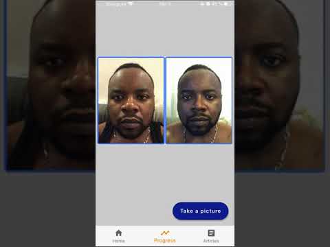 FaceGim (Facial exercises, Fac Video