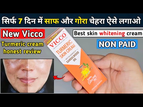Vicco Turmeric Cream | vicco turmeric cream review | vicco turmeric cream ke fayde