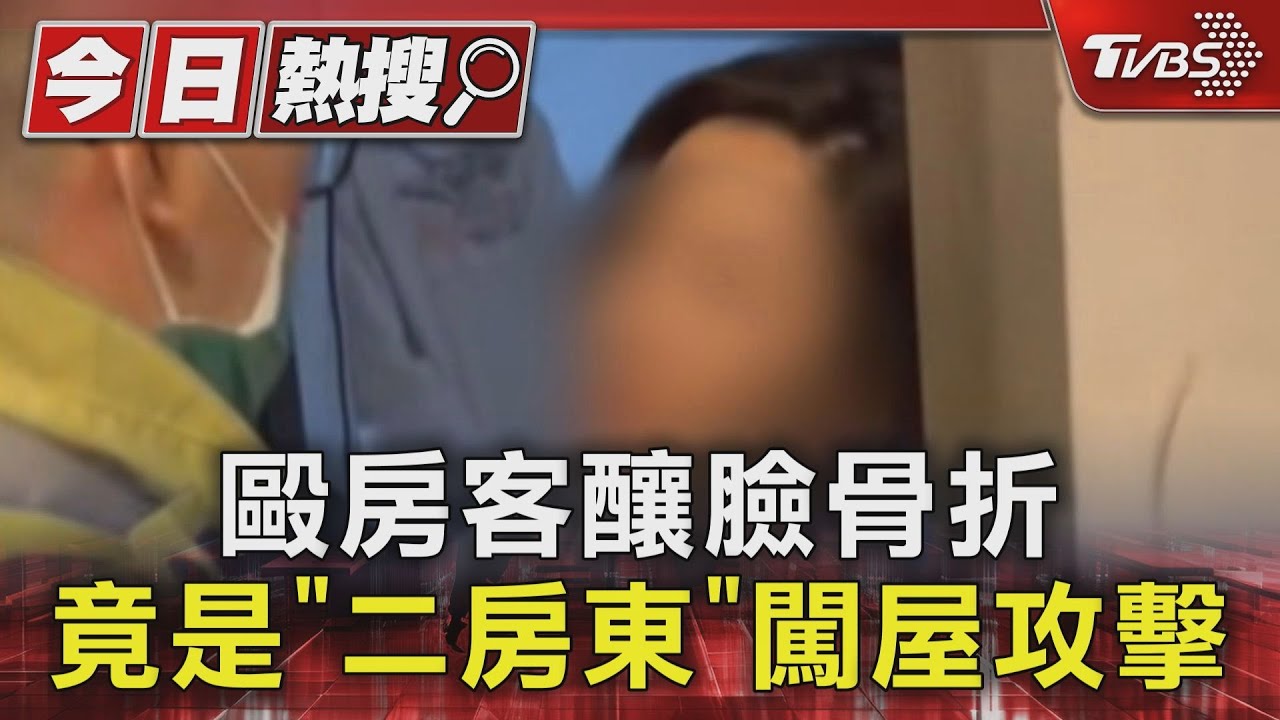 毆房客釀臉骨折 竟是「二房東」闖屋攻擊