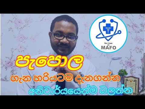 #Varicella #Chickenpox Simply Explained about Chickepox