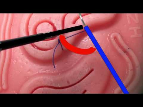 FLS Skills- Laparoscopic Intracorporeal Suturing:Fundamentals and Tips & Tricks for New Learners