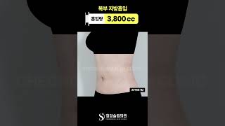 이 정도면 복부 라인 미쳤음 👀