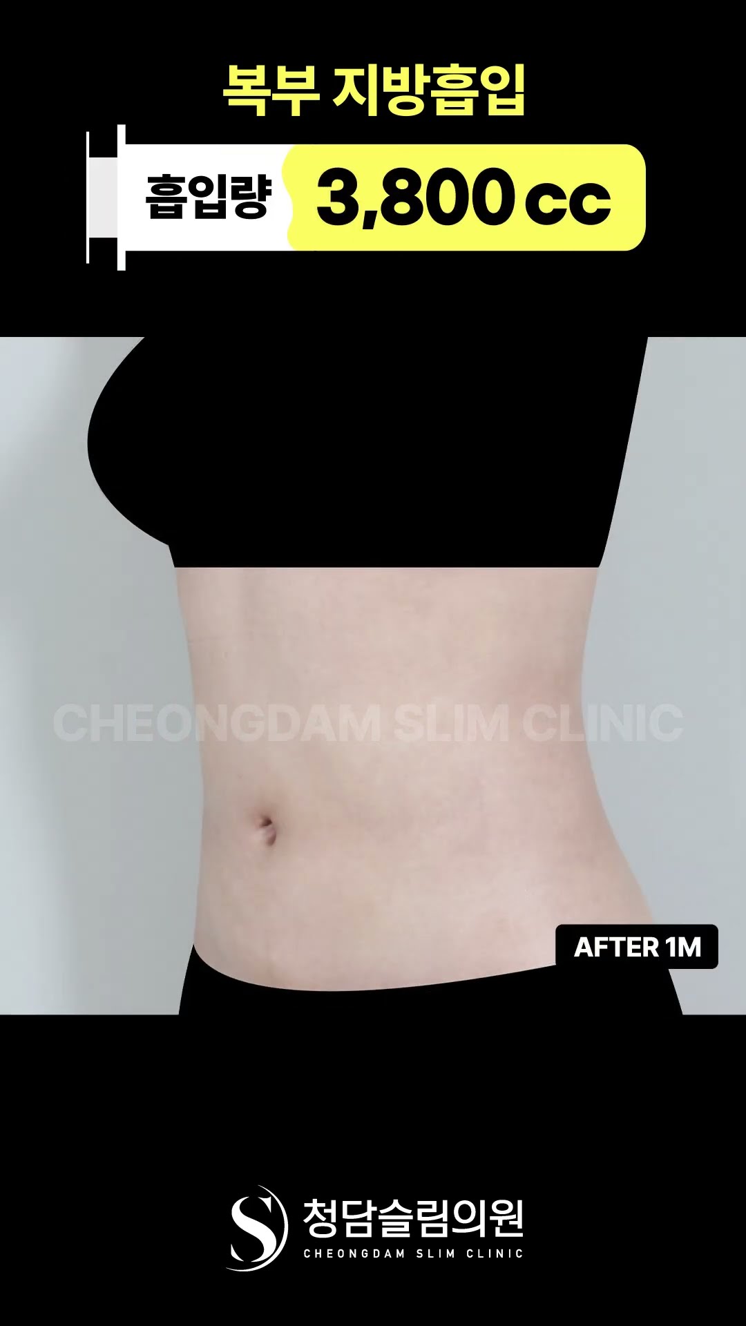 이 정도면 복부 라인 미쳤음 👀
