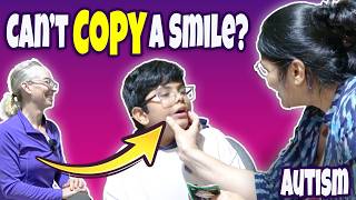 Can’t Copy Facial Movements? Try This Oral Motor Practice 👦🏽💙 | Autism PT #10