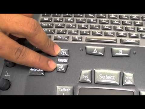 download lagu mp3 mp4 How To Operate Usg Machine, download lagu How To Operate Usg Machine gratis, unduh video klip How To Operate Usg Machine