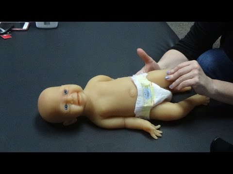 Atypical Development Baby Clubfeet Exercise