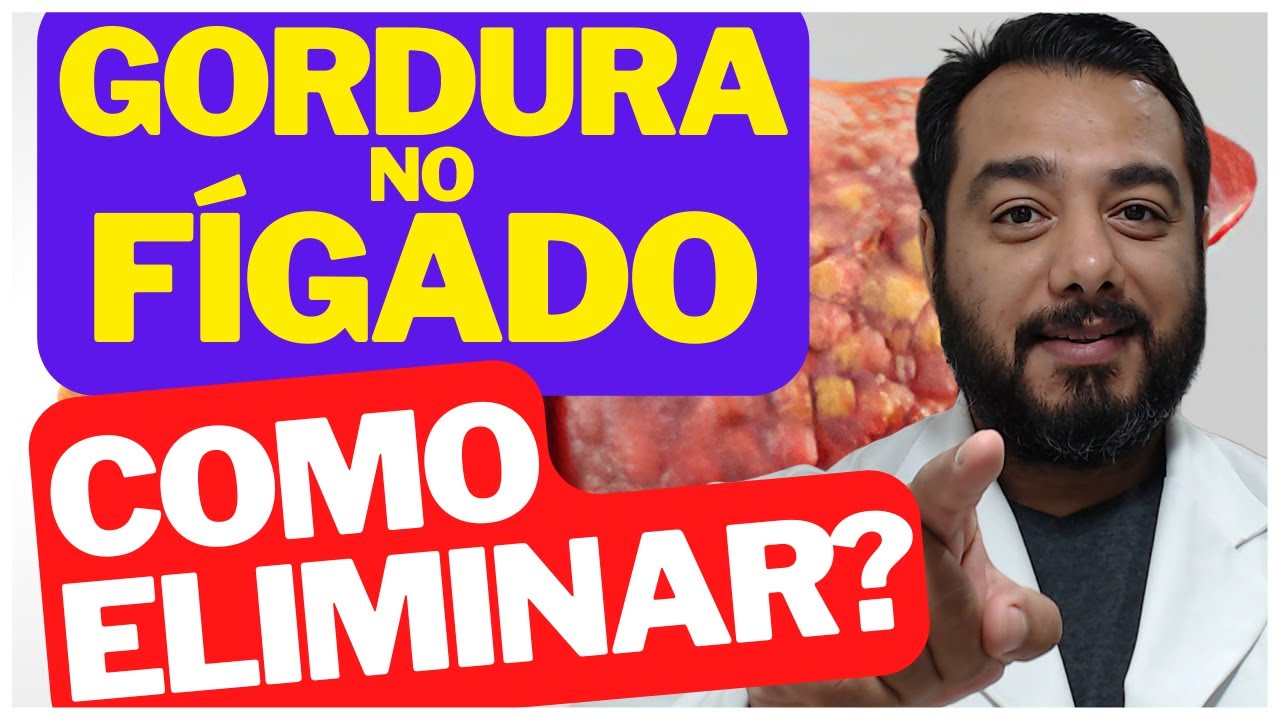 O que fazer para eliminar gordura no fígado (esteatose hepática) | Tratamento | Prof. Victor Proença