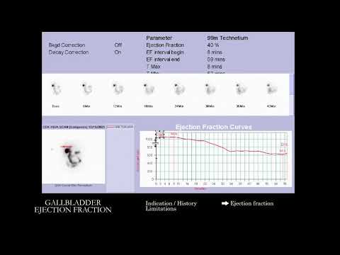 [NM] Gallbladder Ejection Fraction | Search Pattern
