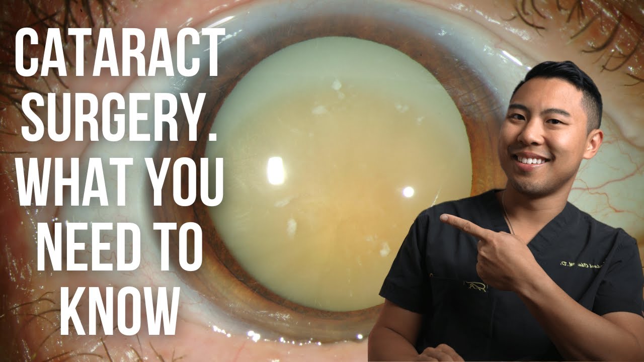 CATARACT SURGERY: Everything you need to know @MichaelRChuaMD