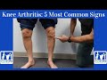 Knee Arthritis 5 Most Common Signs You Have It