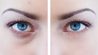 How to Remove Eye Bags in Photoshop
