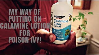 My Way Of Putting On Calamine Lotion - How To Treat Poison Ivy!