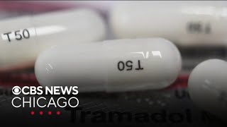 Download lagu New study questions benefit of Tramadol mp3 Download lagu New study questions benefit of Tramadol mp3