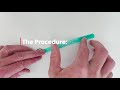 ShangRing Circumcision Procedure Demonstration