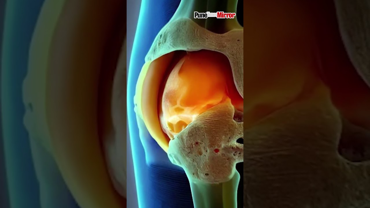 Game Changing Discovery Bioactive Biomaterial for Cartilage Regeneration