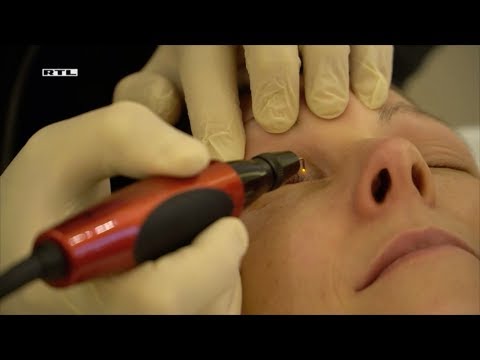 szemészeti klinikák műtét nélküli kezelés