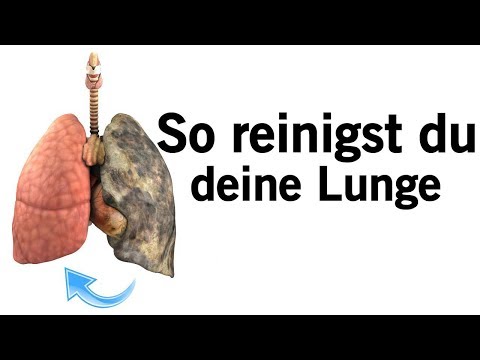 Schmerzen im Rücken links beim Essen Zur Prävention von Gelenken Creme