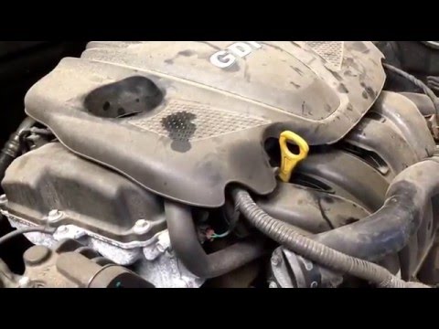 16064C Speedy's Used Parts 2011 Hyundai Sonata 2.4L