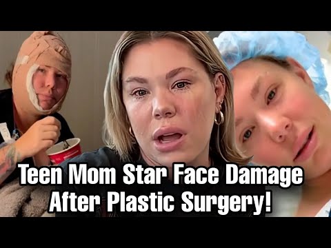 Kailyn Lowry Reveals She Suffers From Facial Paralysis After Undergoing Plastic Surgery.