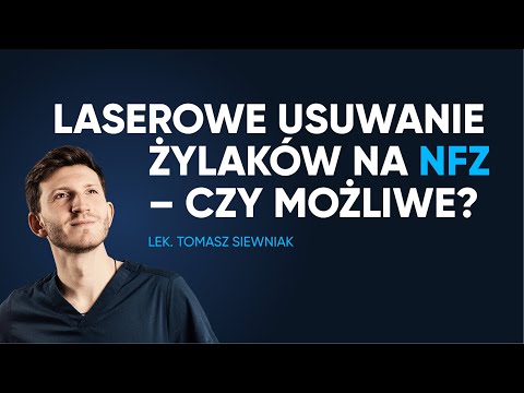 Czy na NFZ można laserowo usunąć żylaki?