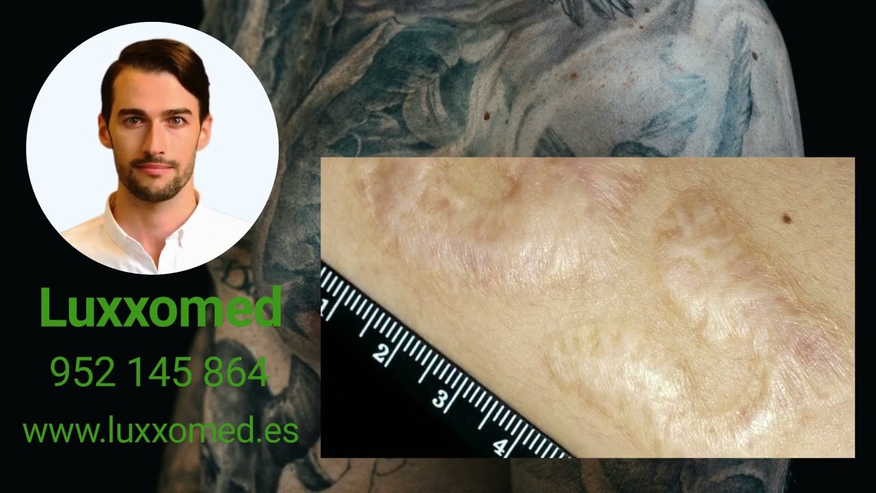 Florián A. Vallecillo Cabrera-6