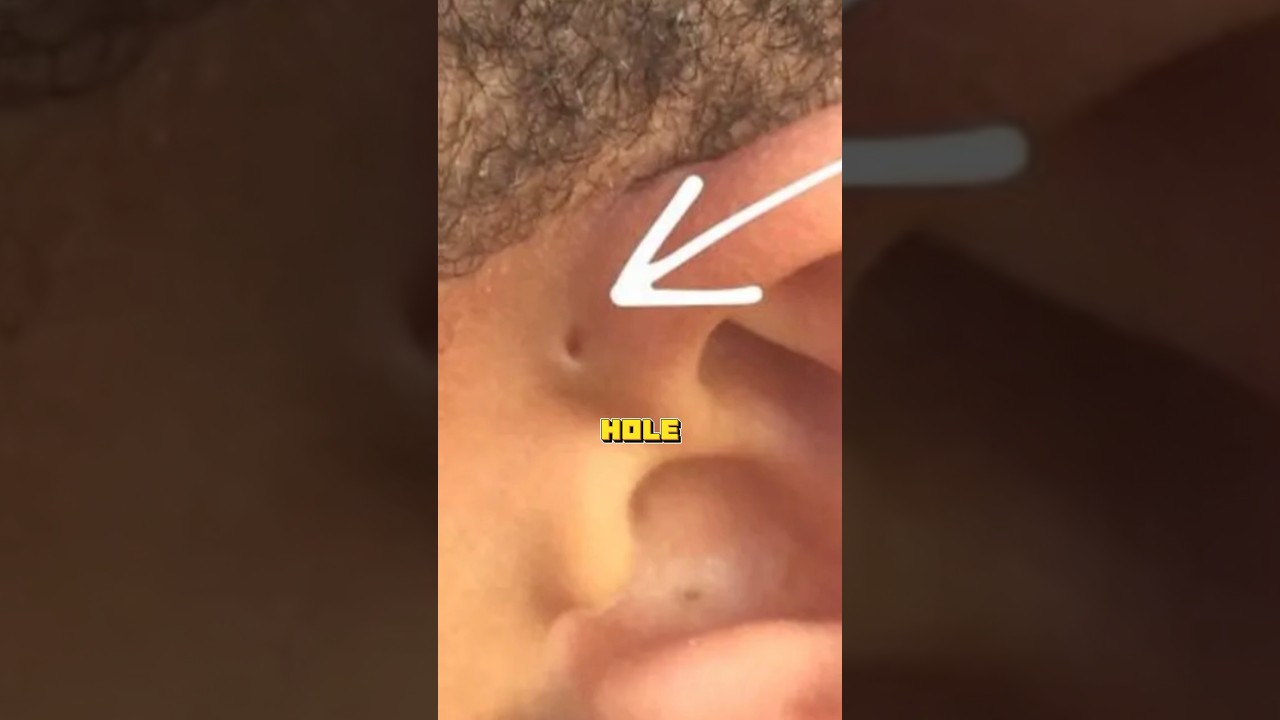 HOW RARE IS YOUR BODY?