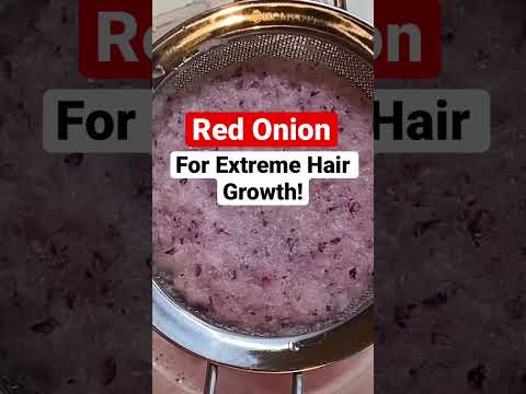 RED ONION JUICE FOR EXTREME HAIR GROWTH! Prevent Dandruff, #SEBORRHEICDERMATITIS  #ONIONJUICE #4C