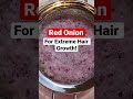RED ONION JUICE FOR EXTREME HAIR GROWTH Prevent Dandruff SEBORRHEICDERMATITIS ONIONJUICE 4C