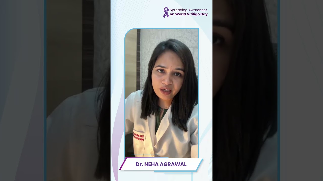 Vitiligo Treatment Ft. Dr Neha Agrawal #vitiligoawarenessmonth #knowyourvitiligo #vitiligopeople
